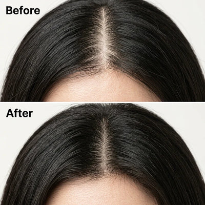 Vossi Korean Scalp Revival Bar