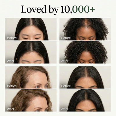 Vossi Korean Scalp Revival Bar