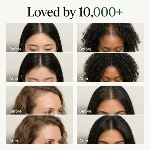 Vossi Korean Scalp Revival Bar