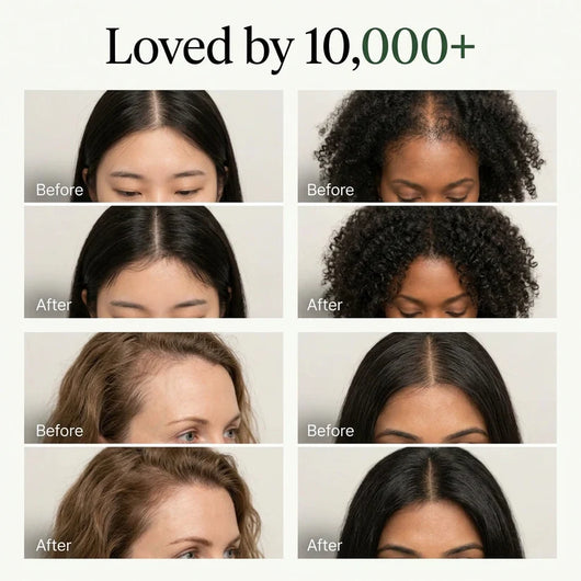 Vossi Korean Scalp Revival Bar